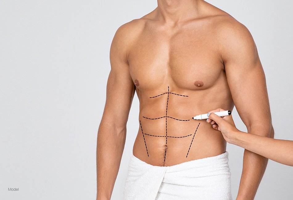 Body Surgery