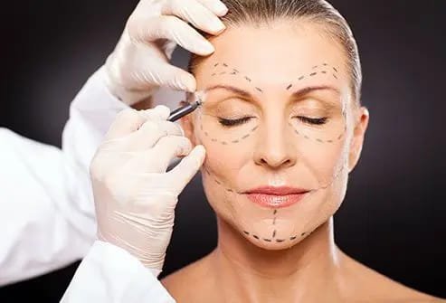 Facial Surgery